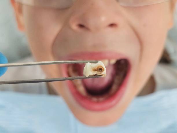 Best Root Canal Emergency Dentist  in Thiells, NY